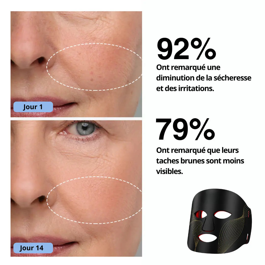 Masque de luminothérapie