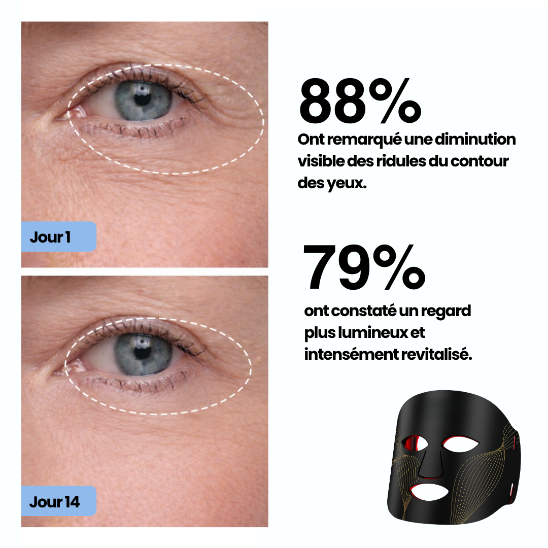 masque de luminautérapie